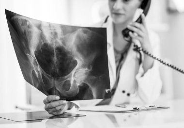 tatlı fluorography üzerinde seyir ve telefonu konuşurken tıp doktoru kadını