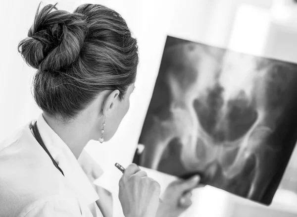 Médico Médico Mujer Buscando Fluorografía Visión Trasera — Foto de Stock