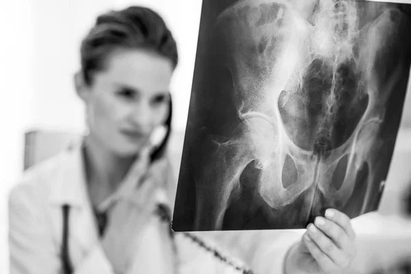 Closeup Medical Doctor Woman Looking Fluorography Talking Phone — Stock Photo, Image