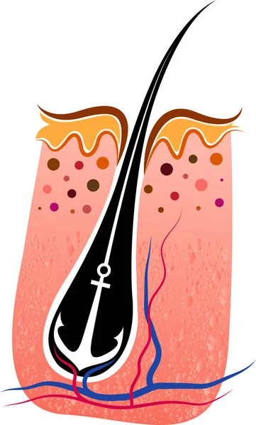 Сильный логотип трансплантации волос — стоковый вектор