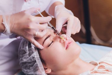 Dudak büyütme hyaluronik asit enjeksiyonu ile prosedürü.