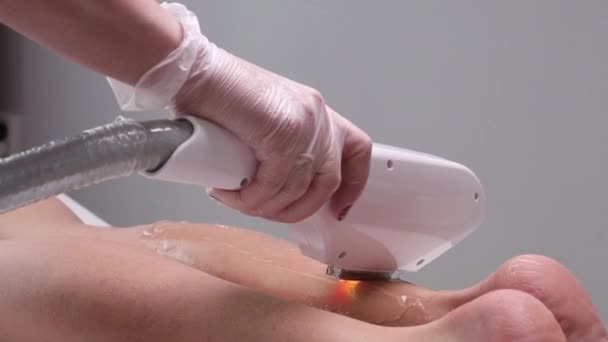 Laser epilering av benet i en modern skönhetssalong. — Stockvideo