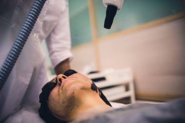 Siyah maskeli kadın prosedür karbon lazer soyarak.