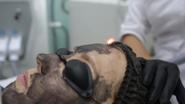 Vrouw in zwart masker op procedure carbon laser peeling. — Stockvideo