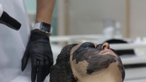 Γυναίκα με μαύρη μάσκα σε διαδικασία ξεφλούδισμα με λέιζερ άνθρακα. — Αρχείο Βίντεο
