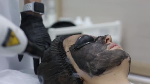 Kvinna i svart mask på förfarande kol laser peeling. — Stockvideo