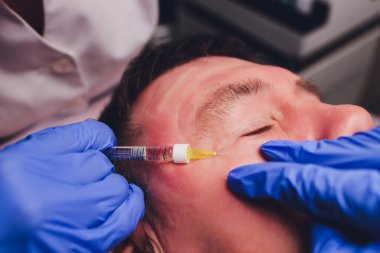 Bir estetik cerrahın elleri hastaların yüzüne hatlar çizer. yüz plastiği prosedürü için.