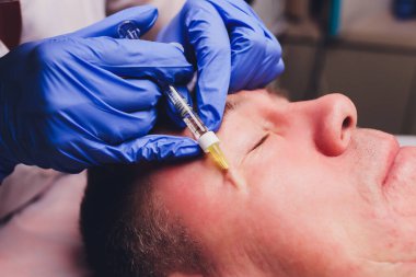 Bir estetik cerrahın elleri hastaların yüzüne hatlar çizer. yüz plastiği prosedürü için.