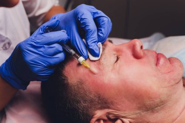 Bir estetik cerrahın elleri hastaların yüzüne hatlar çizer. yüz plastiği prosedürü için.