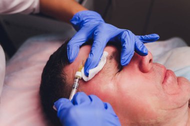 Bir estetik cerrahın elleri hastaların yüzüne hatlar çizer. yüz plastiği prosedürü için.