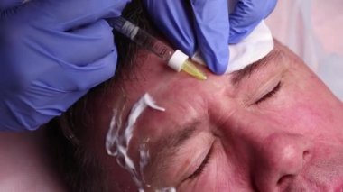 Bir estetik cerrahın elleri hastaların yüzüne hatlar çizer. yüz plastiği prosedürü için.
