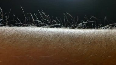 Tüylerim diken diken oldu. Elindeki tüyler diken diken olmuş. Statik elektrik. Elin üstüne ışık düşer.. 