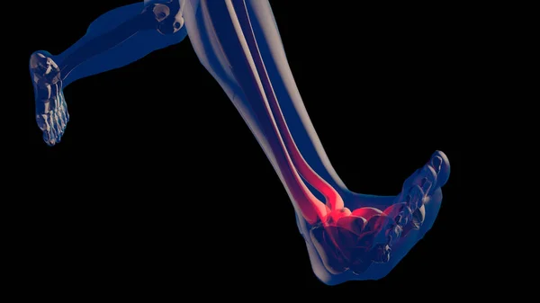 Dolor en el tobillo en el cuerpo humano Diseño transparente —  Fotos de Stock