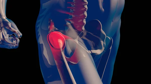 Kalça Femoral baş ve boyun ağrısı insan şeffaf Desig vücut