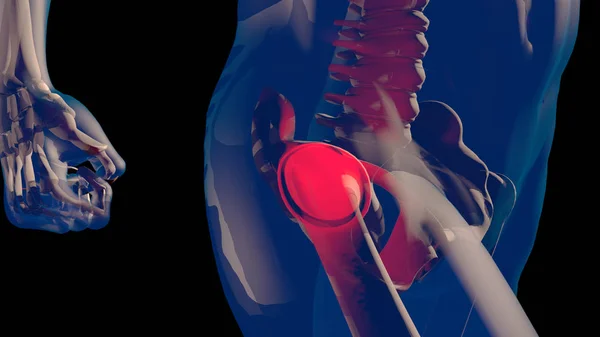 Dij-femurkop en nekpijn in Human Body transparant Desig — Stockfoto