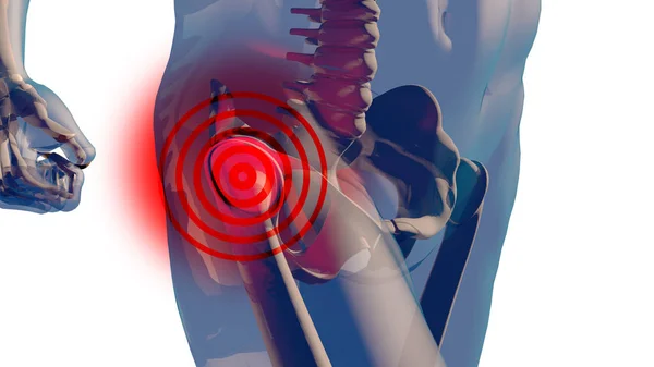 Stehna femuru a bolest krku v lidské tělo průhledné Desig — Stock fotografie