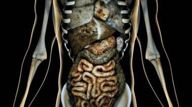 Sick Internal Organs in a Transparent Human Body Anatomical Conc
