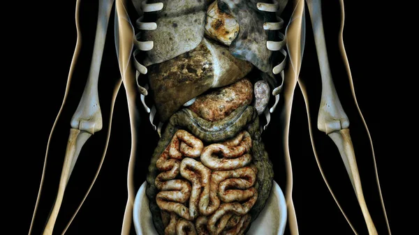 Nemocný vnitřní orgány v transparentní lidské tělo anatomických konc — Stock fotografie