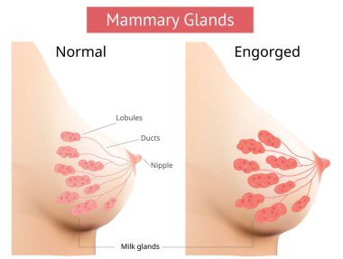 Mammary gland, Non-Lactating and Engorged breast, Female breast Anatomy, Vector. clipart