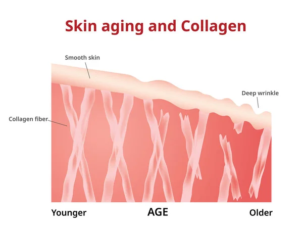 Skin aging, Collagen in young and old skin, — ストックベクタ