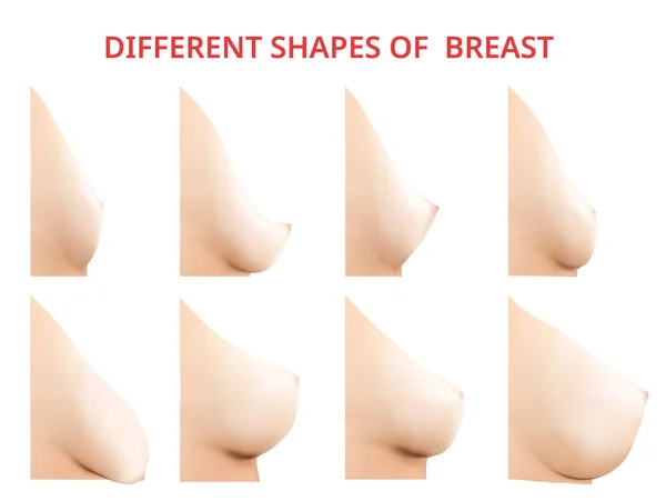 Diverse forme di seno, Donne seno, Vettore illustrazione — Vettoriale Stock