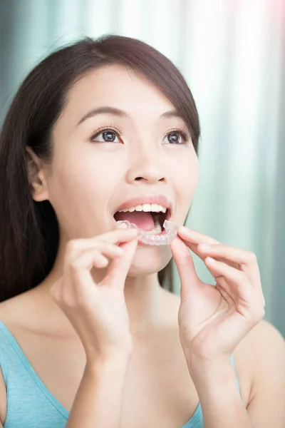 Woman smiling  with invisible braces — Stock Photo, Image