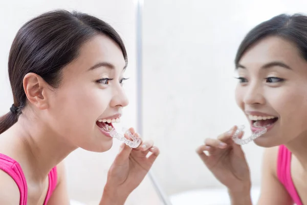 Schöne Frau mit unsichtbaren Zahnspangen — Stockfoto