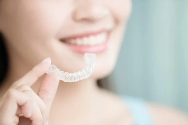 Görünmez diş telleri ile güzel kadın — Stok fotoğraf