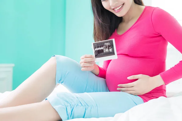Woman holding  ultrasound photo — Stock Photo, Image