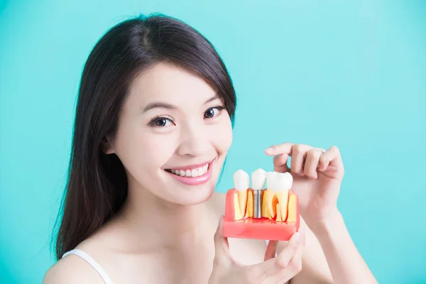 Mujer sosteniendo implante dental —  Fotos de Stock