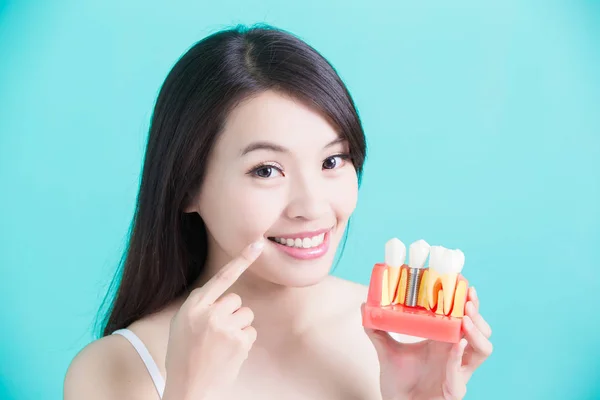 歯インプラント モデルを保持している女性 — ストック写真