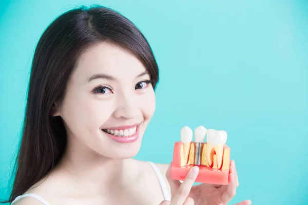 Mulher segurando modelo de implante dentário — Fotografia de Stock