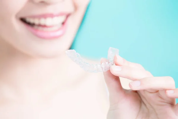 Woman with  invisible braces — Stock Photo, Image