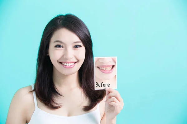 Vrouw met tanden foto — Stockfoto