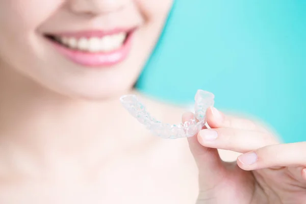 Woman with  invisible braces — Stock Photo, Image