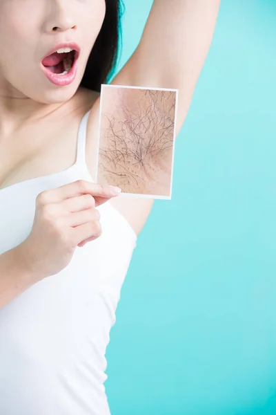 Woman  with under armpit problem — Stock Photo, Image