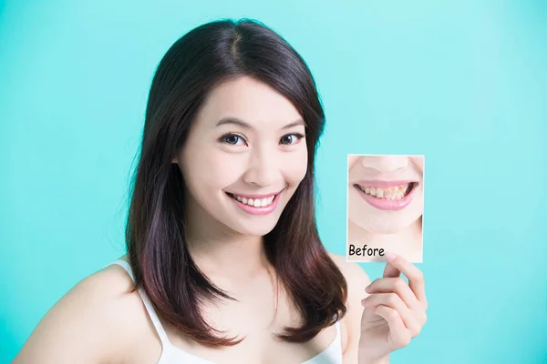 Mujer con dientes imagen — Foto de Stock