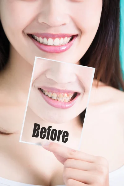 Mujer con dientes blanquear sosteniendo imagen — Foto de Stock