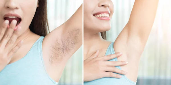 Woman with armpit plucking problem — Stock Photo, Image