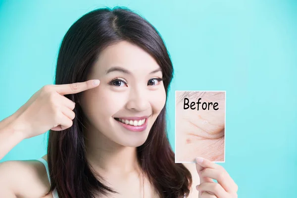 Skincare woman with  picture — Stock Photo, Image