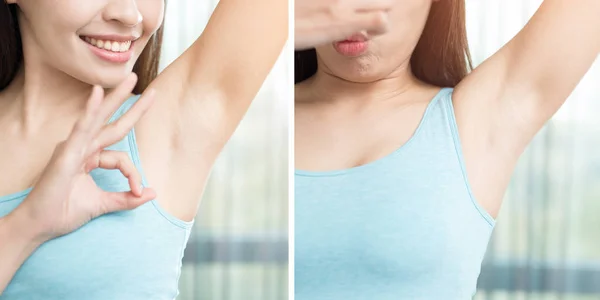 Vrouw met lichaam geur probleem — Stockfoto