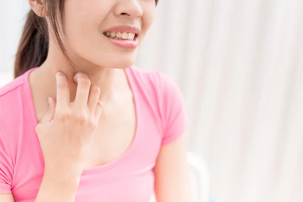 Woman with itchy skin problem — Stock Photo, Image