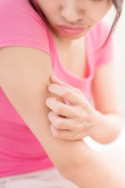 Woman with itchy skin problem — Stock Photo, Image