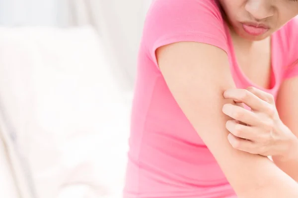 Woman with itchy skin problem — Stock Photo, Image