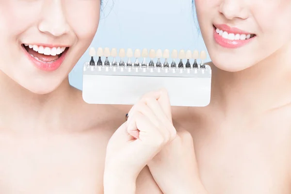 Mulheres com amostra de cor dos dentes — Fotografia de Stock