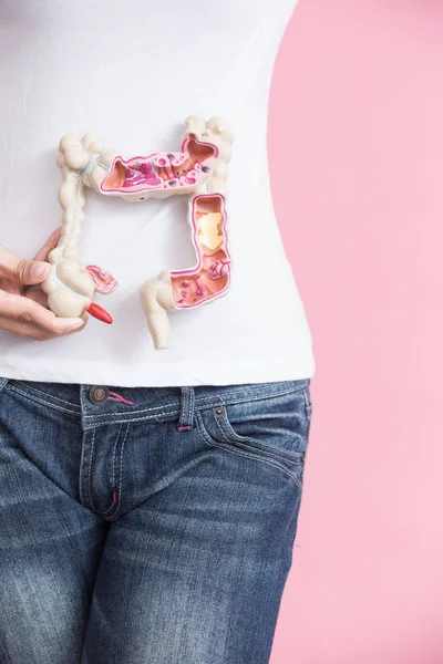 大腸癌を持つ女性 — ストック写真