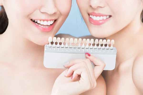 Donne con campione di colore dei denti — Foto Stock