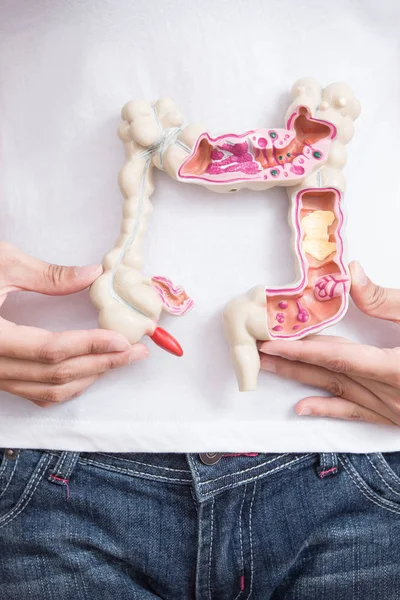 Femme avec un échantillon de cancer colorectal — Photo