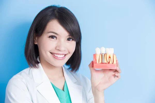 Dentista mostrando dente de implante — Fotografia de Stock