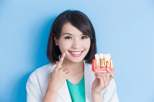 Dentista mostrando diente de implante — Foto de Stock